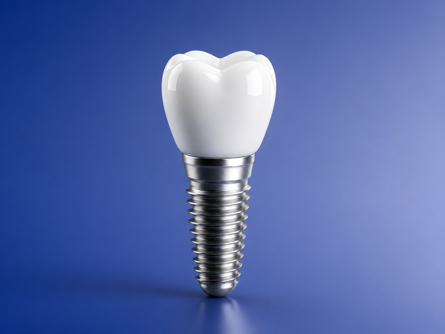 Implants illustration